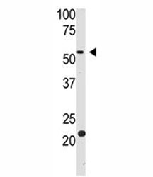 BACE2 Antibody