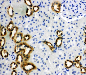 PBP Antibody
