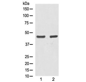 Alpha Actin Antibody / ACTA1 (skeletal muscle)