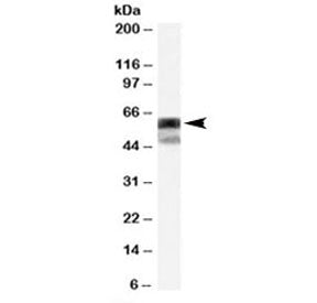 P4HA1 Antibody