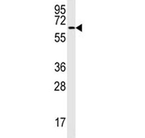 MAP2 antibody western blot analysis in MCF-7 lysate. Ab used at 1:1000 dilution. MAP2 can be observe