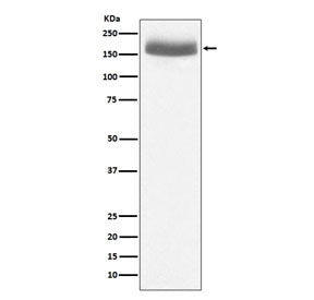 EGF Antibody / Epidermal Growth Factor
