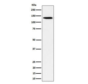 Western blot testing of human HeLa cell lysate with recombinant TRIM24 antibody. Expected molecular