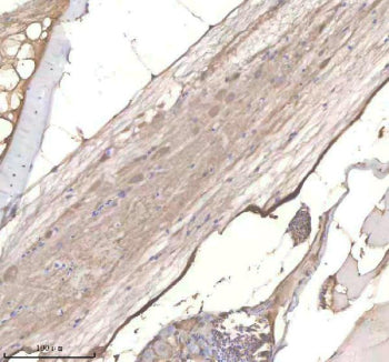 IHC staining of zebrafish Phyhipl/b protein using Zebrafish Phyhipl antibody, HRP-labeled secondary