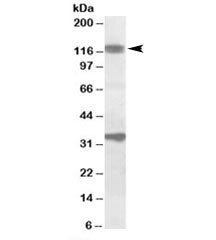 CCAR1 Antibody
