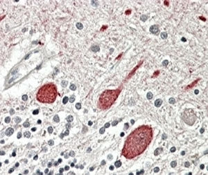 Melatonin receptor 1B Antibody