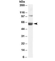 HNF1B Antibody