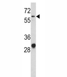 Western blot analysis of CD166 antibody and NCI-H460 lysate. Predicted molecular weight ~65 kDa (unmodified), 100-105 kDa (glycosylated).