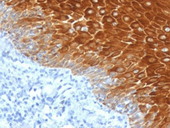 Keratin 6 Antibody / Cytokeratin 6