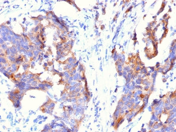 MUC1 Antibody / Mucin-1