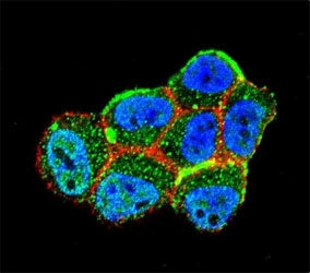 LKB1 Antibody (Liver Kinase B1)