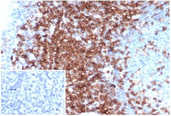 IHC staining of FFPE human tonsil tissue with CD43 antibody (clone MT-1). Inset: PBS instead of prim
