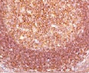 Bcl10 Antibody