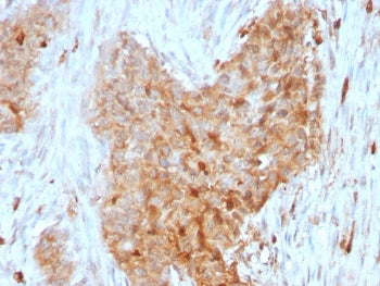 GPI Antibody / Glucose-6-phosphate isomerase