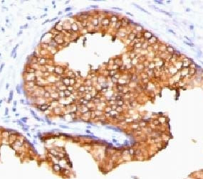 Ornithine Decarboxylase Antibody / ODC1