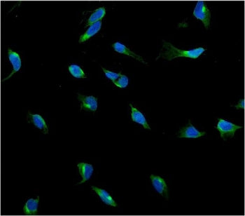 USP15 Antibody