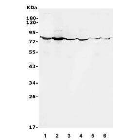 Western blot testing of 1) human HeLa, 2) human HEK293, 3) rat kidney, 4) rat RH35, 5) mouse kidney