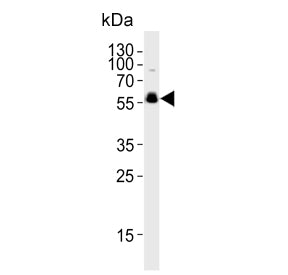 Western blot testing of human brain tissue lysate with Cyclin-dependent kinase 14 antibody. Predicte