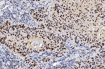 FEN1 Antibody / Flap endonuclease 1