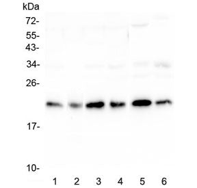 Western blot testing of human 1) HeLa, 2) placenta, 3) HepG2, 4) MCF7, 5) mouse testis and 6) mouse