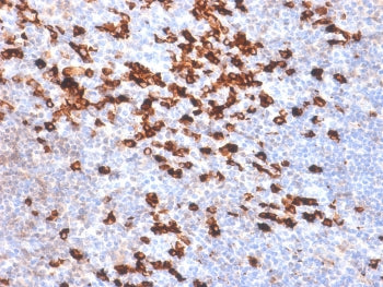 Kappa Light Chain Antibody