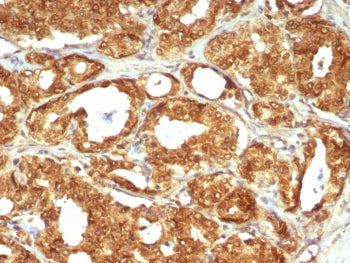 MIF Antibody / Macrophage migration inhibitory factor