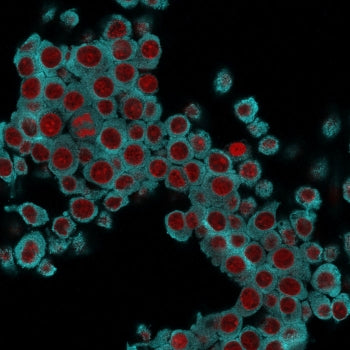 Keratin 6 Antibody / Cytokeratin 6