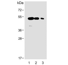 Equilibrative nucleoside transporter 1 Antibody / ENT1