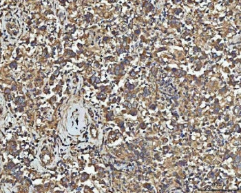 NPEPPS Antibody