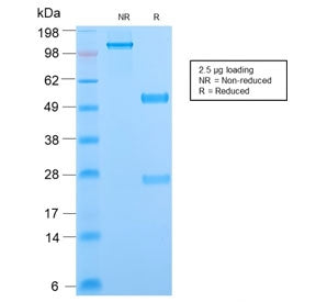 SDS-PAGE analysis of purified, BSA-free Phosphotyrosine antibody (clone PY2870R) as confirmation of