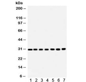 Western blot testing of 1) rat brain, 2) rat liver, 3) rat kidney, 4) mouse brain, 5) Jurkat, 6) CEM