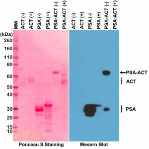 Prostate Specific Antigen Antibody / PSA