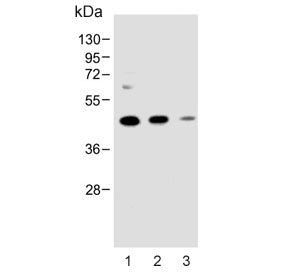 MEK1 Antibody / MAP2K1