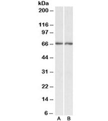 Acetylcholinesterase Antibody