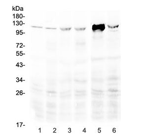 RIG-I Antibody (DDX58)