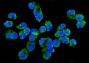 Immunofluorescent staining of FFPE human T-47D cells with TARS2 antibody (green) and DAPI nuclear st