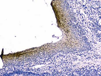 IHC testing of FFPE human tonsil tissue with Stefin B antibody at 2ug/ml. HIER: boil tissue sections