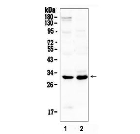 Western blot testing of 1) rat brain and 2) mouse spleen lysate with IL1B antibody at 0.5ug/ml. Pred