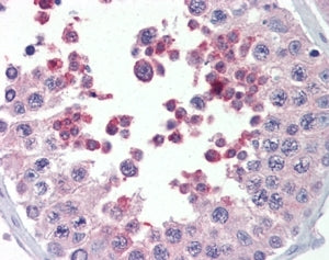 MLL4 Antibody