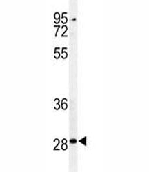 Caspase-3 Antibody, 0.08ml