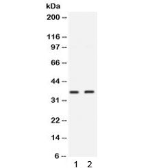 Western blot testing of 1) MCF7 and 2) 22RV1 lysate with SIX1 antibody. Predicted molecular weight ~