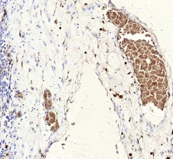 FLI1 Antibody