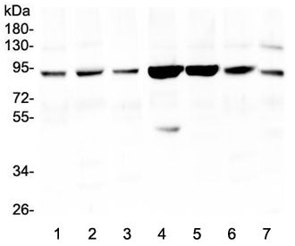 Gelsolin Antibody