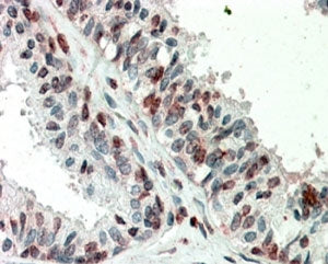 ZIC3 Antibody