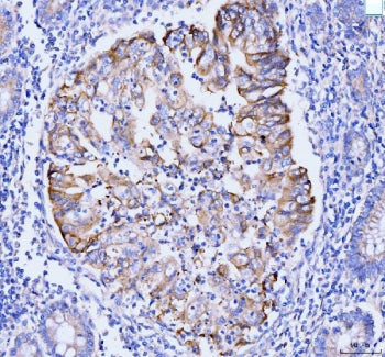 GSPT1/2 Antibody / eRF3A/B