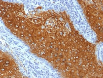 IHC testing of FFPE human skin with Keratin 10 antibody (clone KRT10/844). Required HIER: boil tissu