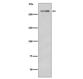 Dysferlin Antibody / DYSF