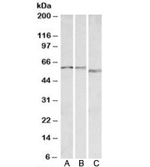 Western blot testing of A) human, B) mouse and C) rat heart lysate with ADRA1B antibody at 0.1ug/ml.