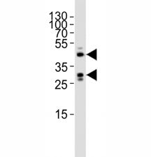 SIRT3 Antibody