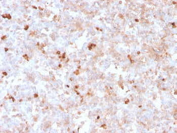 Lambda Light Chain Antibody / Lambda Antibody